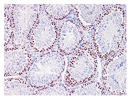 Buy 2, get the 3rd recombinant rabbit mAb FREE-16