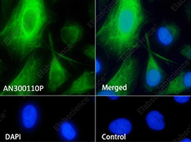 Buy 2, get the 3rd recombinant rabbit mAb FREE-17