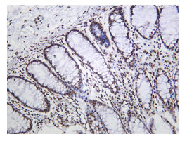 Buy 2, get the 3rd recombinant rabbit mAb FREE-20