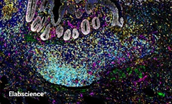 Human Appendiceal Tissue