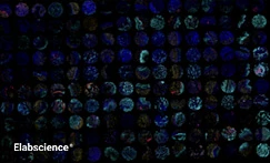 Human Pancreatic Cancer Chip