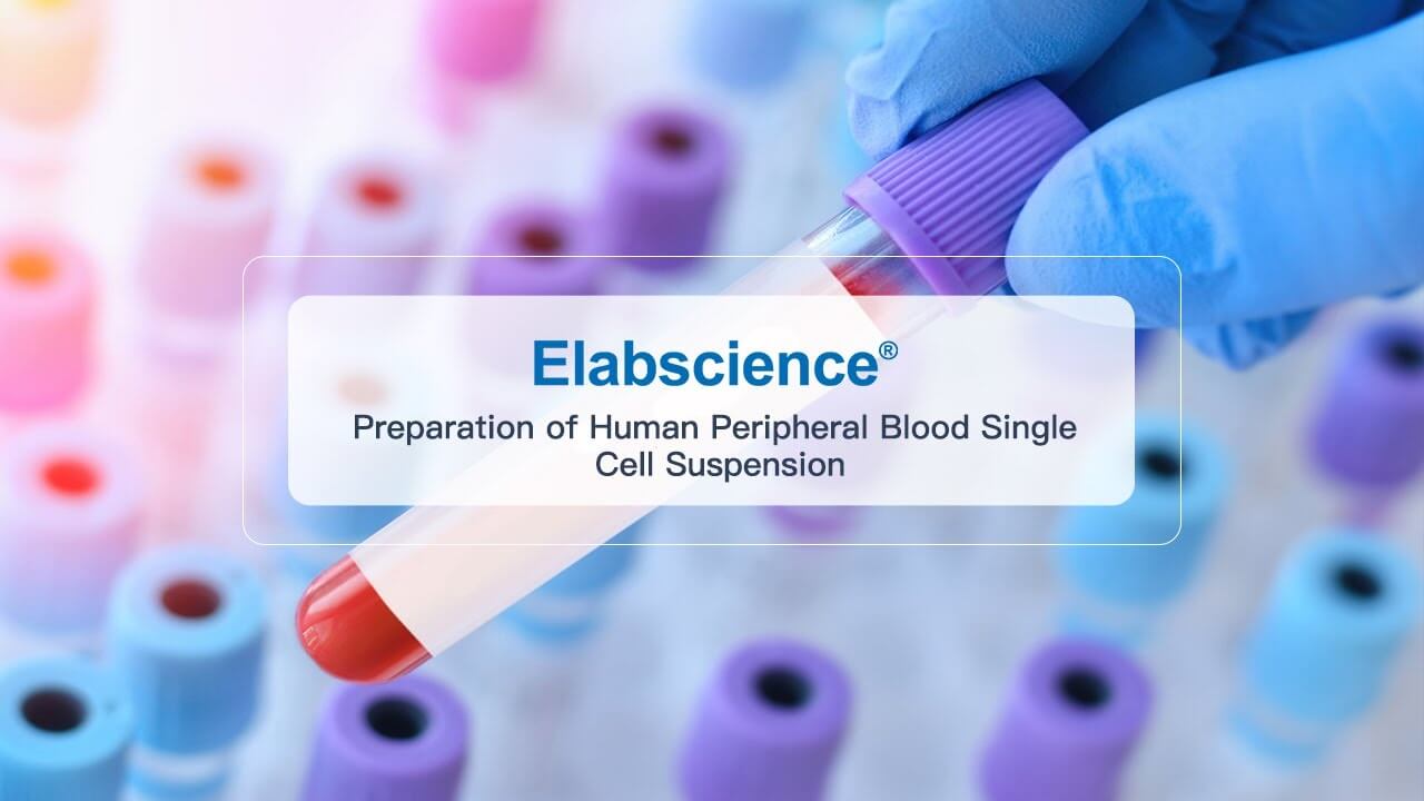 Preparation of Human Peripheral Blood Single Cell Suspension