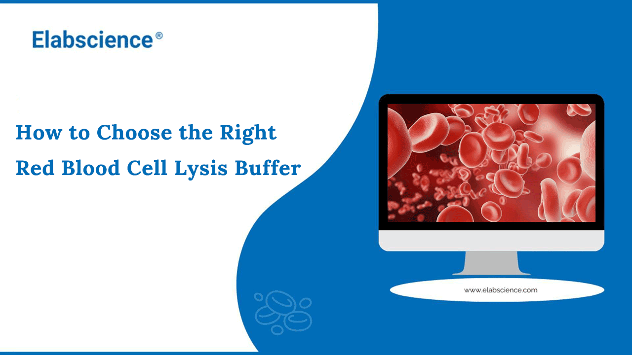 How to Choose the Right Red Blood Cell Lysis Buffer