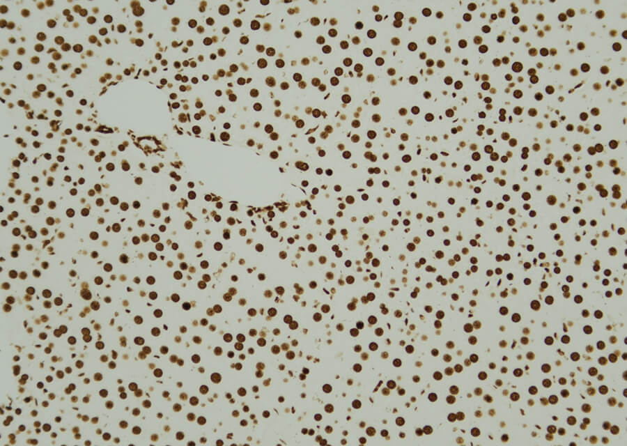 Results of TUNEL In Situ Apoptosis Kit (HRP-DAB Method)1