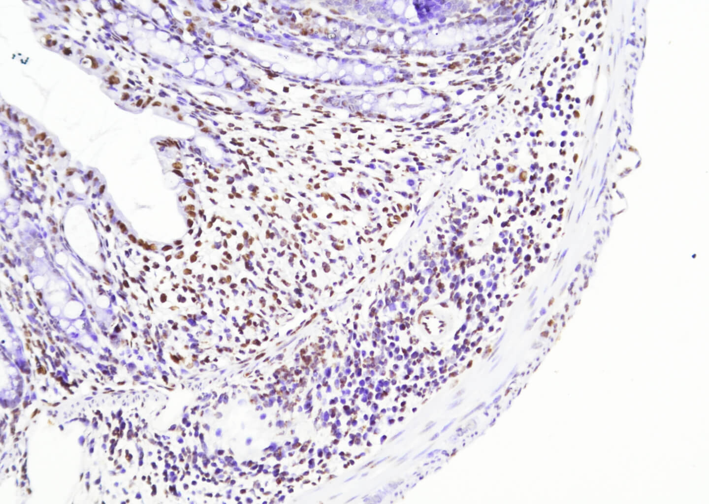 Results of TUNEL In Situ Apoptosis Kit (HRP-DAB Method)2