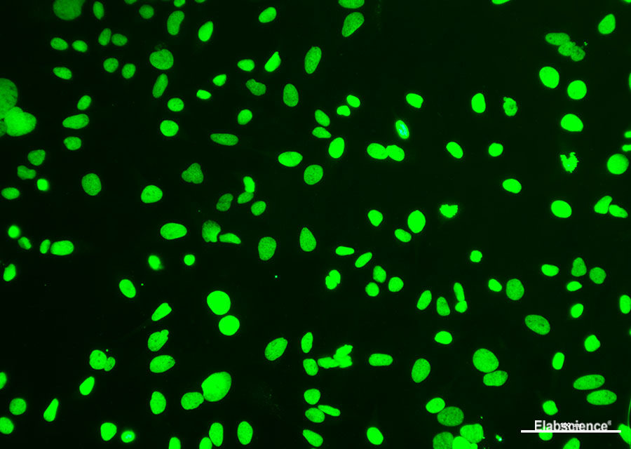 Hela cells was treated with DNase I to fragment the DNA. DNA strand breaks showed intense fluorescent staining in DNase I treated sample.(Green)