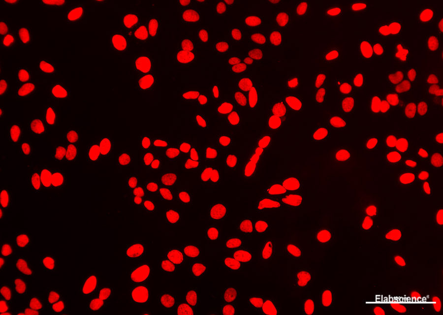 Hela cells was treated with DNase I to fragment the DNA. DNA strand breaks showed intense fluorescent staining in DNase I treated sample.(Red)