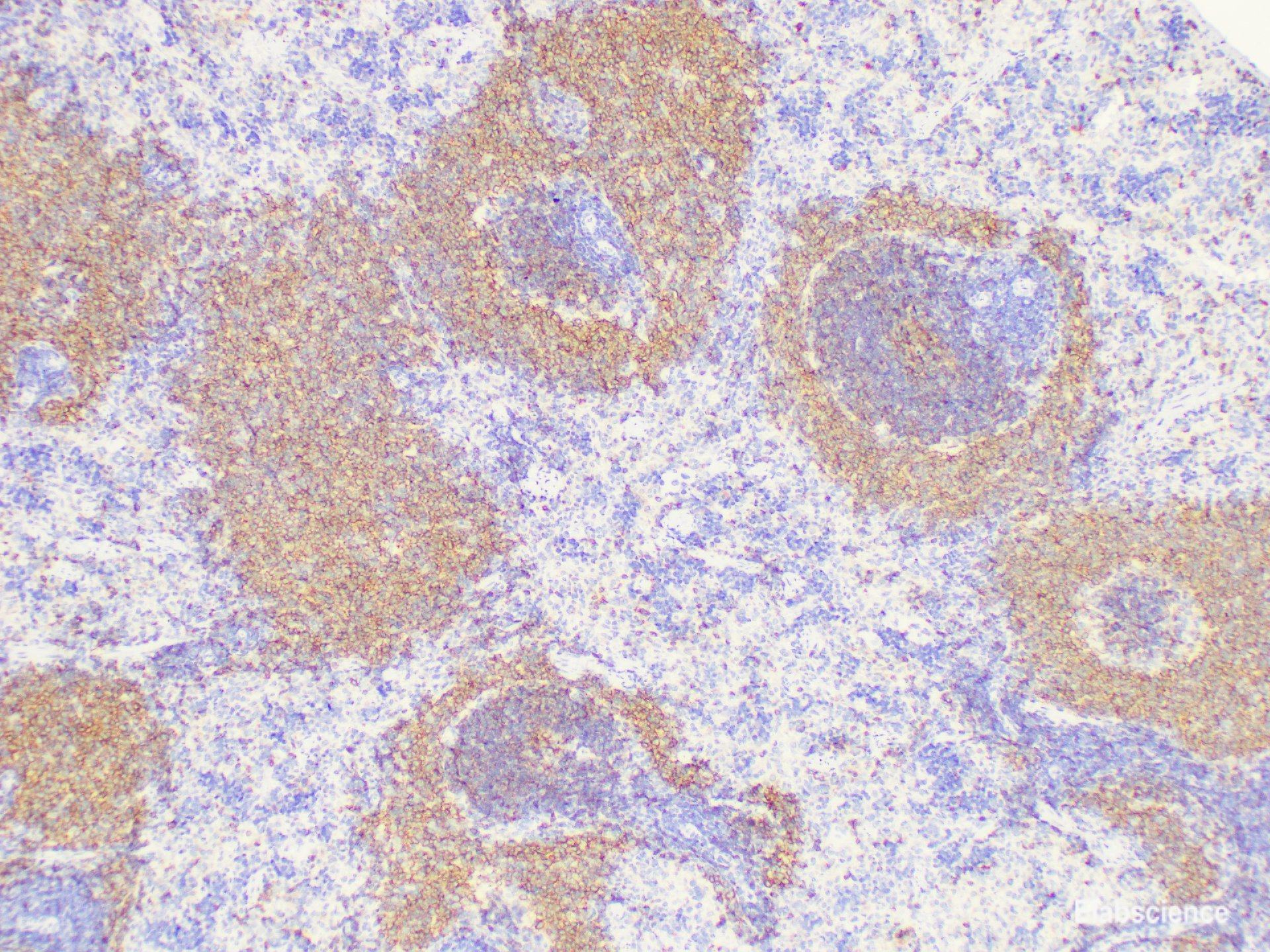 High Affinity And Specificity CD20 Polyclonal Antibody E AB 40362 At high-affinity-and-specificity-cd20-polyclonal-antibody-e-ab-40362-at