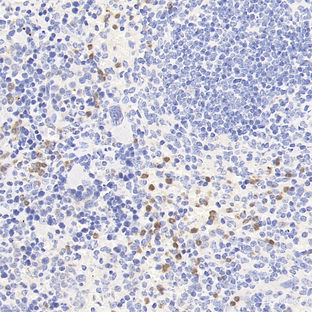 High Affinity and Specificity CCR5 Polyclonal Antibody E-AB-70361 at ...