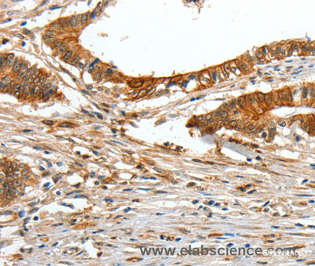 polyclonal antibody-Elabscience