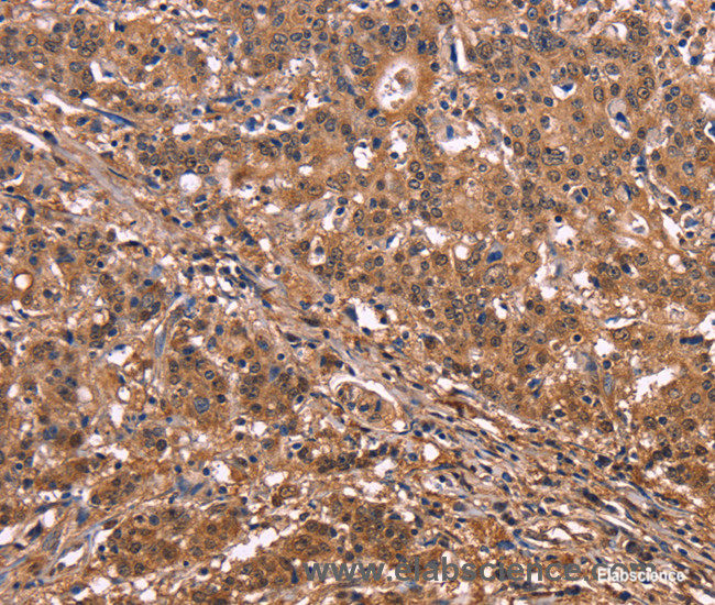 polyclonal antibody-Elabscience