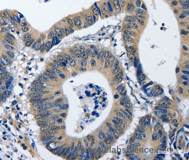 polyclonal antibody-Elabscience