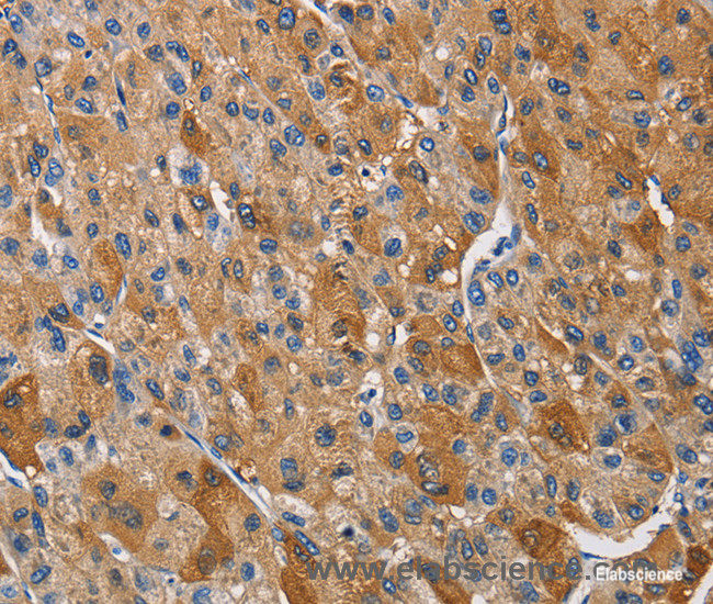 High Affinity and Specificity KLK1 Polyclonal Antibody E-AB-14179 at ...