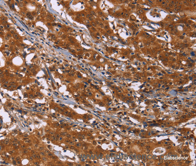 High Affinity and Specificity DCBLD2 Polyclonal Antibody E-AB-14932 at ...