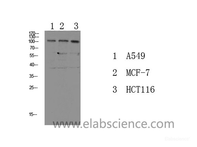methyl antibody-Elabscience