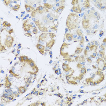 High Affinity and Specificity PRKAG1 Polyclonal Antibody E-AB-61632 at ...