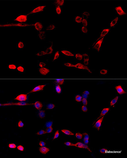 High Affinity And Specificity Aspscr1 Polyclonal Antibody E Ab At Elabscience Com