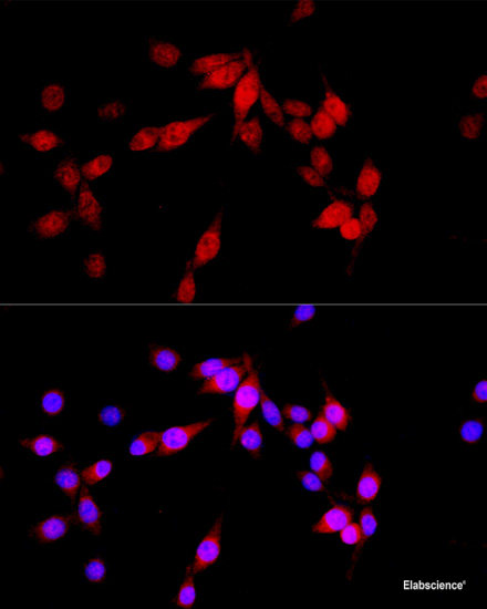 High Affinity And Specificity Aspscr1 Polyclonal Antibody E Ab At Elabscience Com