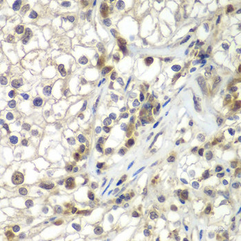 High Affinity And Specificity Aspscr1 Polyclonal Antibody E Ab At Elabscience Com