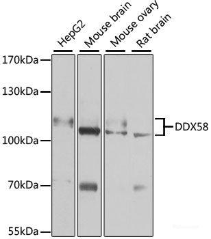 High Affinity and Specificity DDX58 Polyclonal Antibody at Elabscience.com