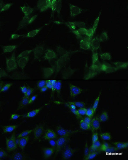High Affinity and Specificity HSP90AA1 Polyclonal Antibody EAB65909