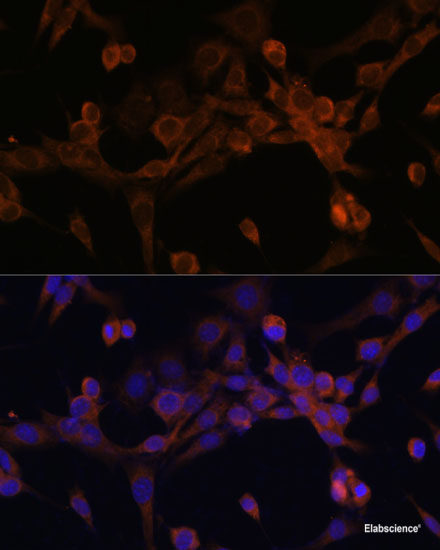 High Affinity and Specificity EIF2B2 Polyclonal Antibody E-AB-67811 at ...