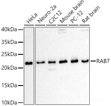 High Affinity and Specificity RAB7A Polyclonal Antibody E-AB-68291 at ...