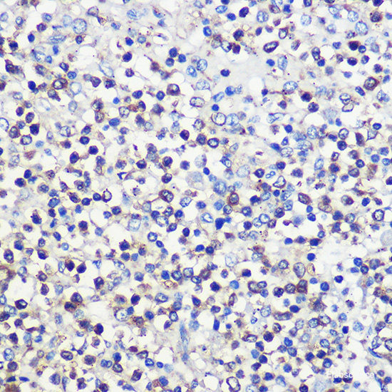 High Affinity and Specificity CD80 Polyclonal Antibody E-AB-68320 at ...