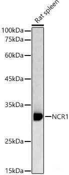 High Affinity and Specificity NCR1 Polyclonal Antibody E-AB-90867 at ...