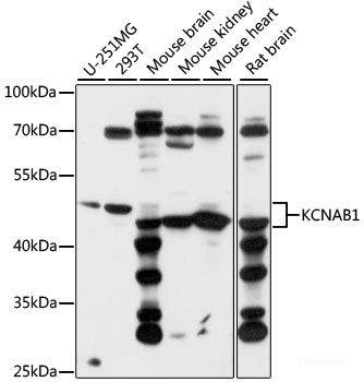 High Affinity And Specificity Kcnab1 Polyclonal Antibody E-ab-91124 At 