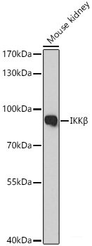 High Affinity and Specificity IKKβ Polyclonal Antibody E-AB-93301 at ...