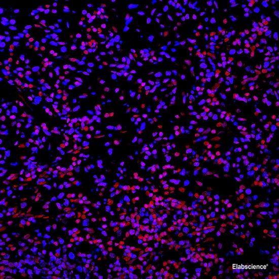 Paraffin embedded mouse spleen was treated with DNase I to fragment the DNA. DNA strand breaks showed intense fluorescent staining in DNase I treated sample (blue). The cells were counterstained with PI (red).This photo was taken by confocal microscope.