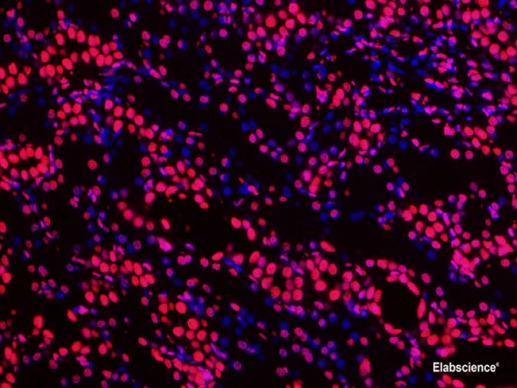 Paraffin embedded rat kidney was treated with DNase I to fragment the DNA. DNA strand breaks showed intense fluorescent staining in DNase I treated sample (red). The cells were counterstained with DAPI (blue).