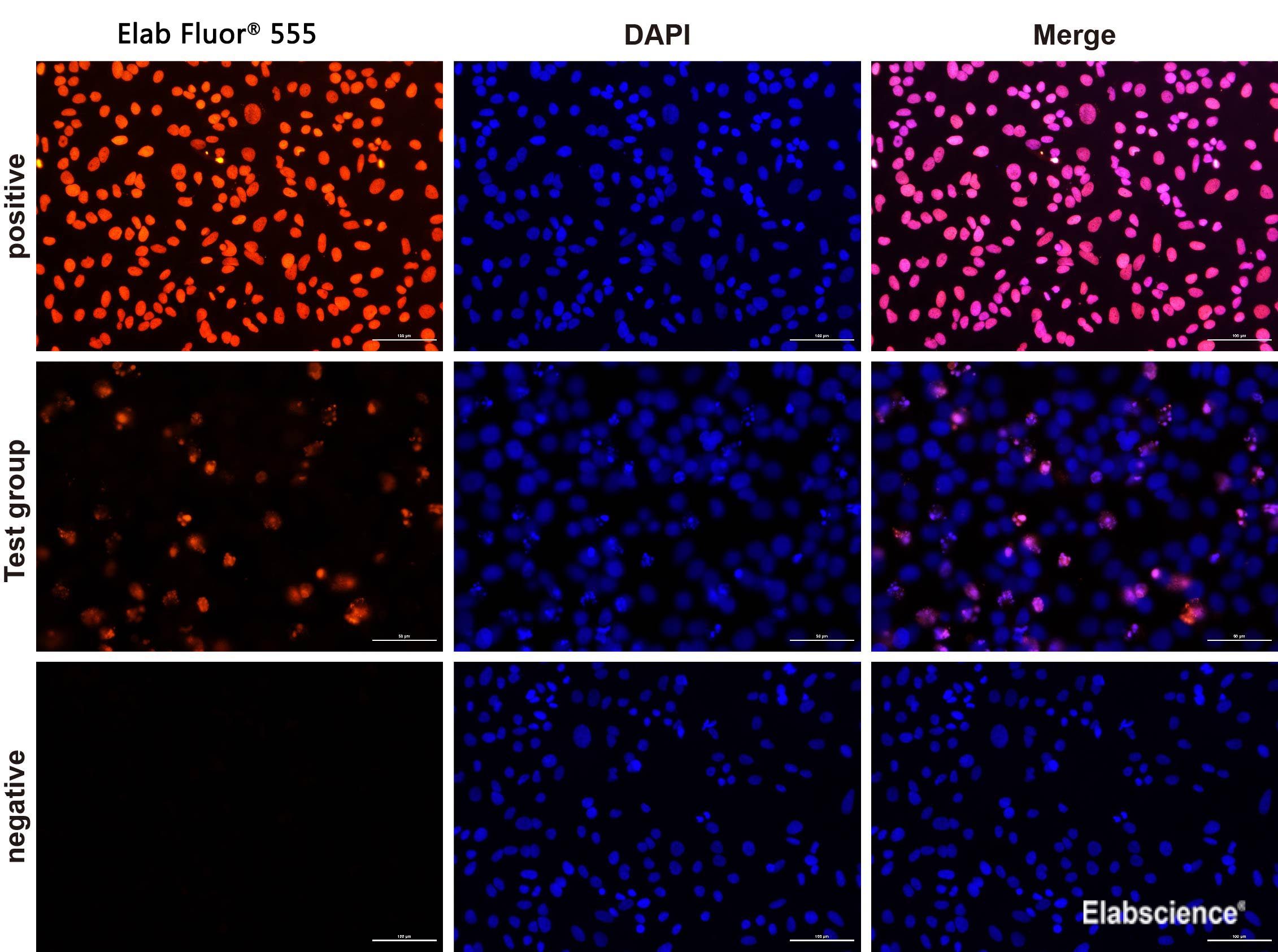 Fluorescence microscope analysis of camptothecin-induced apoptosis of Hela cells.