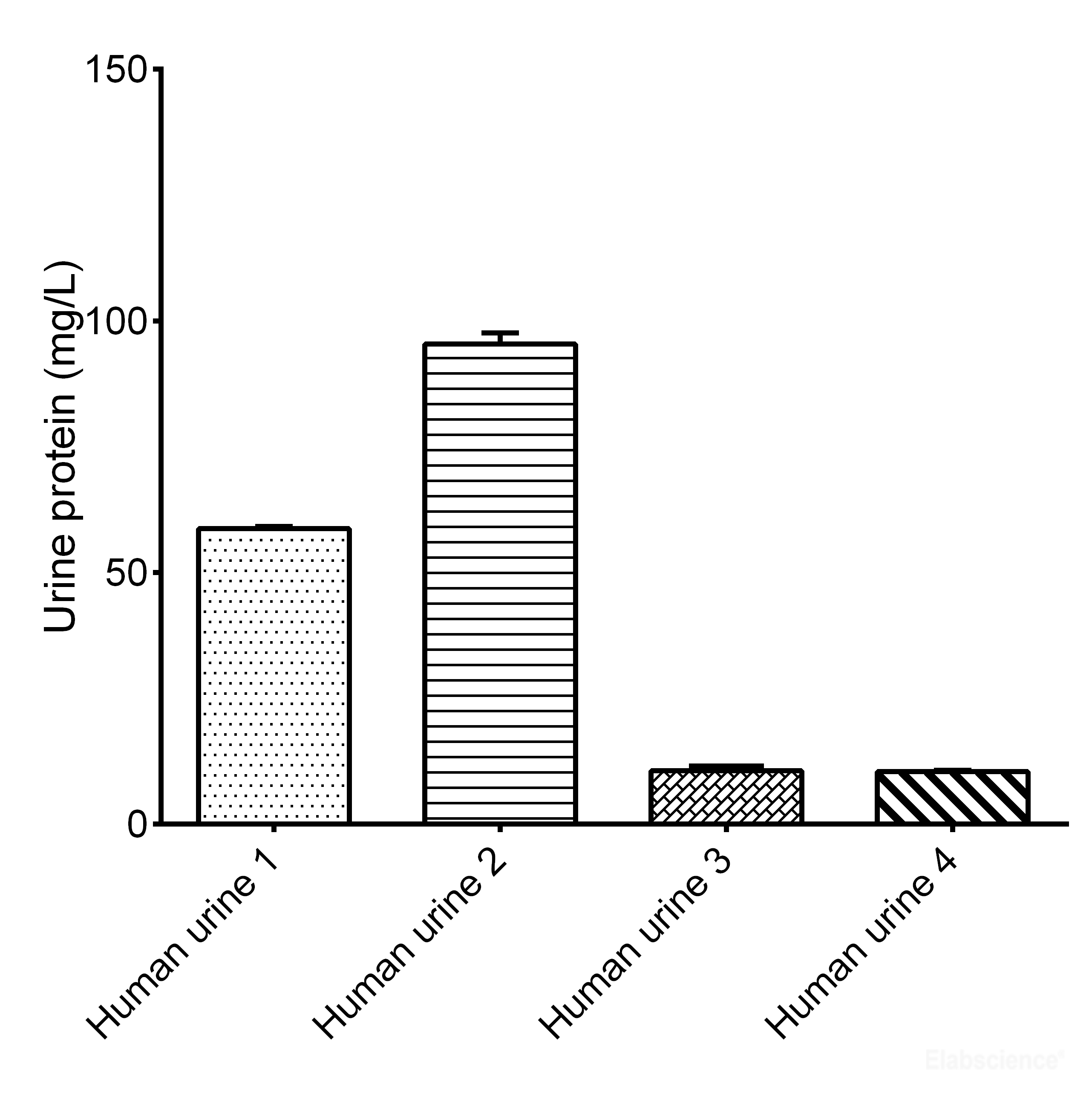 High Affinity and Specificity Urine Protein Colorimetric Assay Kit EBC