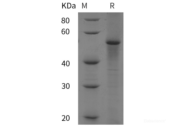 Recombinant Bovine P53/TP53 protein (His tag)