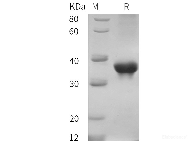 Recombinant Cynomolgus macaques ABL1 protein (His tag)