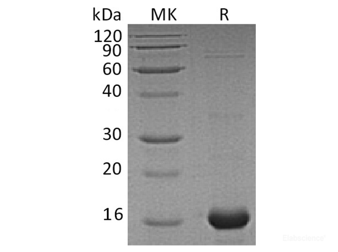 Recombinant Human AIF1 Protein (His Tag)