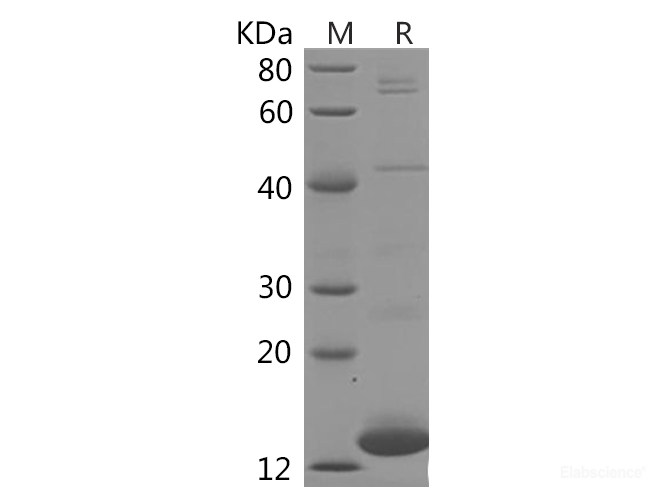 Recombinant Human FABP3 Protein (His Tag)