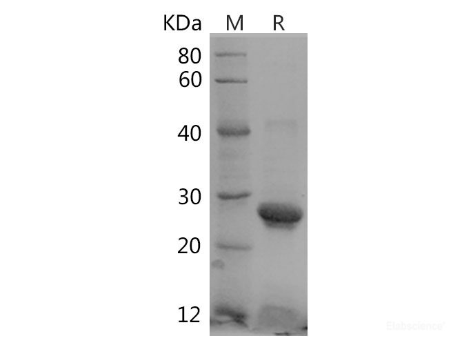 Recombinant Human Rac1 protein(His tag)