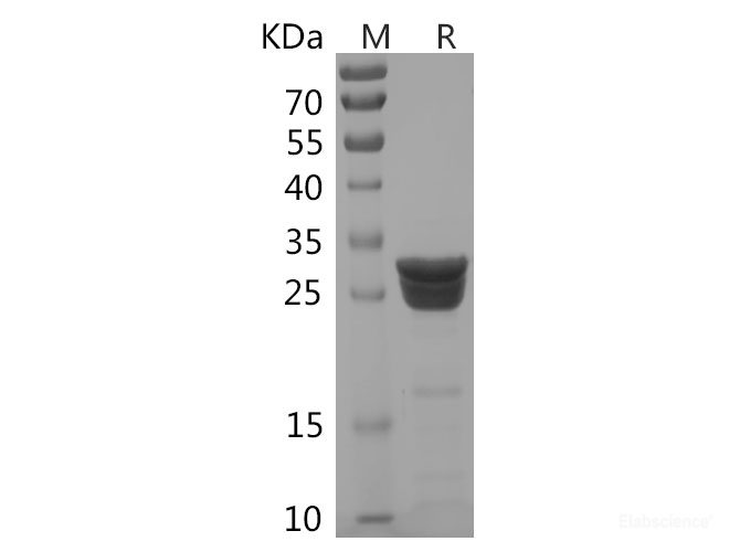 Recombinant Human MR-ProADM protein(His tag)