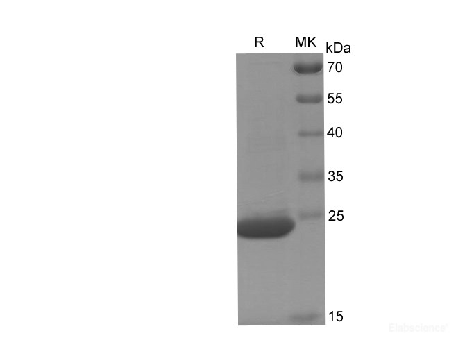 Recombinant Human CDC42 protein(His tag)