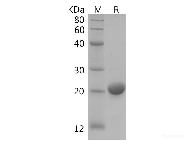 Recombinant Human RAC1 protein(His tag)