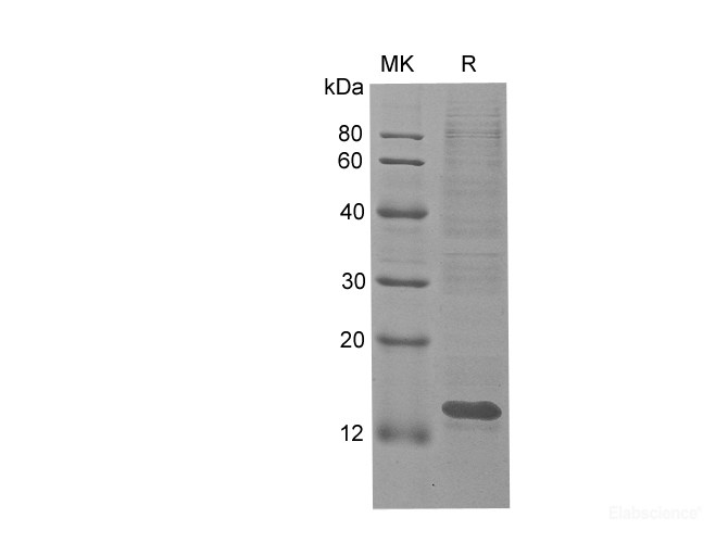 Recombinant Human KI67 protein(His tag)