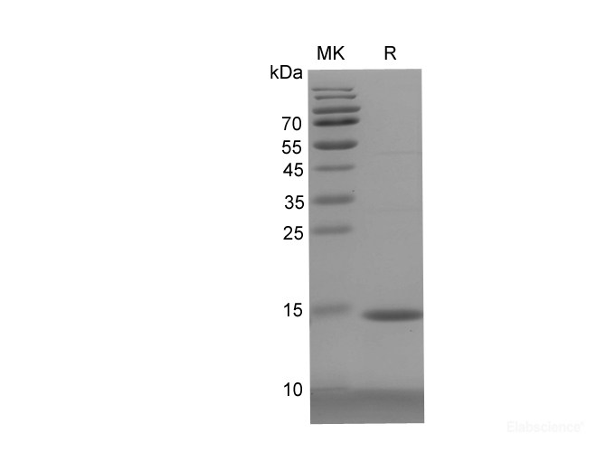Recombinant Human Lamin B1 protein(His tag)