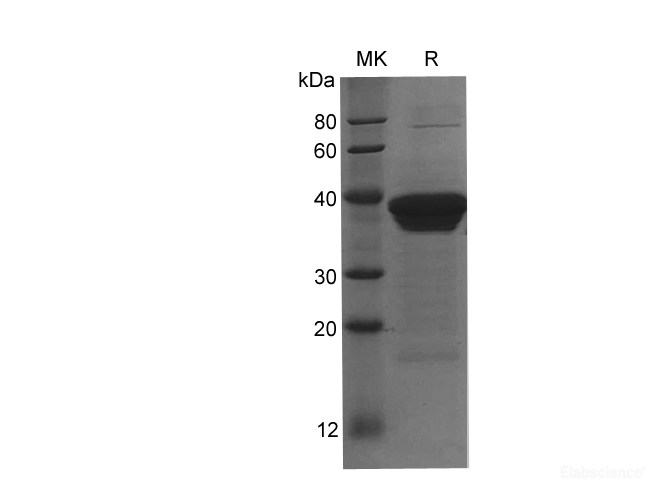 Recombinant Human ACTN4 protein(His tag)