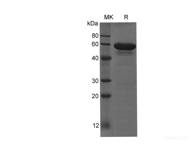 Recombinant Human SCG3 protein(His tag)