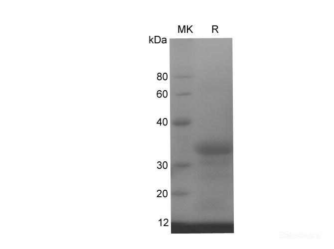 Recombinant Human BMPR2 protein(His tag)