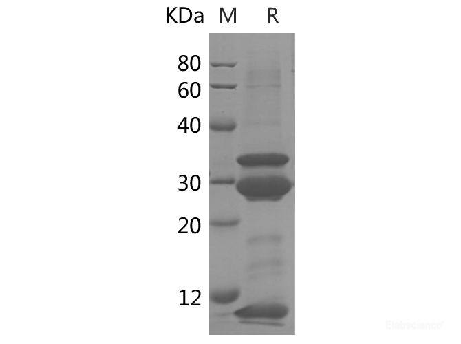 Recombinant Human IL-8 protein(GST tag)