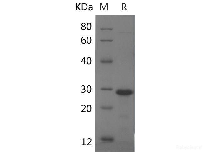 Recombinant Human HSPG1 protein(His tag)